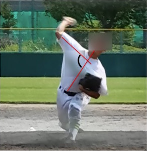 ピッチャーフォーム